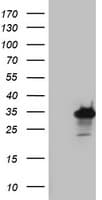 PRX-1 / PRRX1 Antibody (clone OTI1C2)
