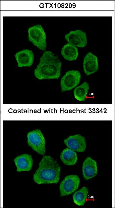 IHC-plus™ Polyclonal Rabbit anti-Human PTGFRN Antibody (aa815-879, IHC, WB)