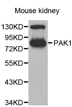 Polyclonal Rabbit anti-Human PAK1 Antibody (IHC, WB)