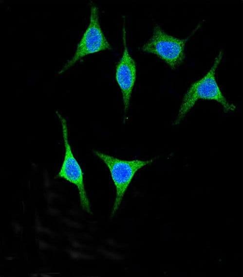 IHC-plus™ AMY2A / Pancreatic Amylase Antibody (aa484-511)