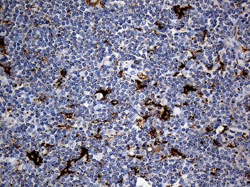 PTPN22 / PEP Antibody (aa359-449, clone OTI6B1)
