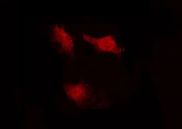 Polyclonal Rabbit anti-Human AURKA / Aurora-A Antibody (IF, WB)