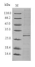 Human ADTRP / C6orf105 Protein (Recombinant 10His, N-terminus + Myc, C-terminus)