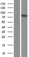 ZNF282 Protein (Over-Expression Lysate Myc-DDK (Flag))