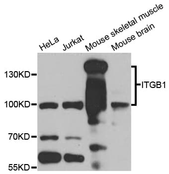 ITGB1 / Integrin Beta 1 / CD29 Antibody