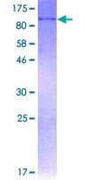 Human AOC3 / VAP-1 Protein (Recombinant GST)