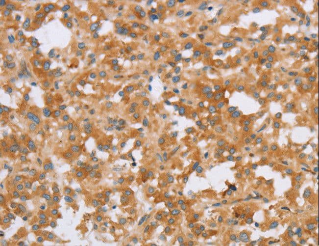 Polyclonal Rabbit anti-Human CRELD2 Antibody (IHC, WB)