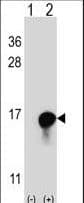 FKBP1A / FKBP12 Antibody (aa55-83)
