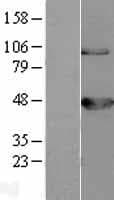 Human BCKDK Protein (Over-Expression Lysate Myc-DDK (Flag))