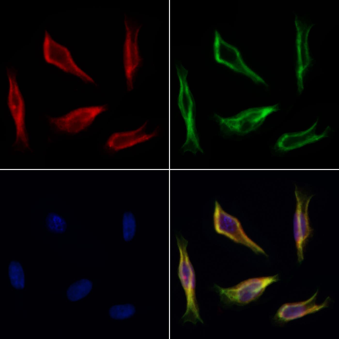 Polyclonal Rabbit anti-Human FARS2 Antibody (IF, WB)
