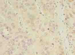 Polyclonal Rabbit anti-Human ASB11 Antibody (IHC)
