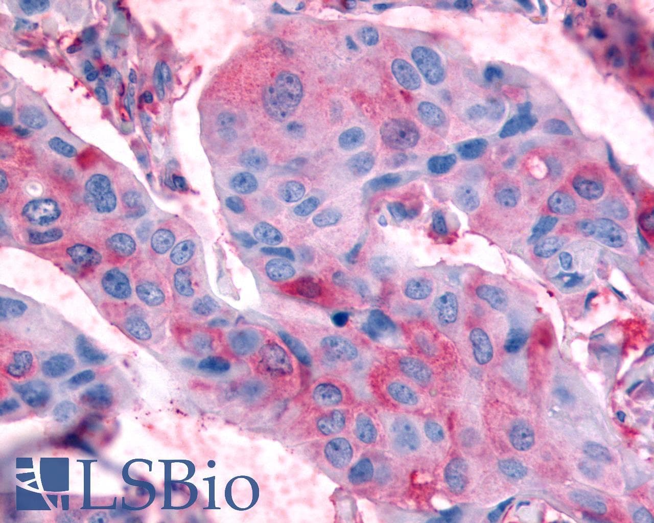 PathPlus™ Polyclonal Rabbit anti-Human RXFP2 / LGR8 Antibody (Extracellular Domain, IHC)