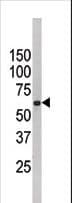 FUBP3 Antibody (aa38-67)