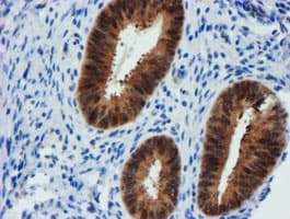 FBXO21 Antibody (clone OTI5H4)