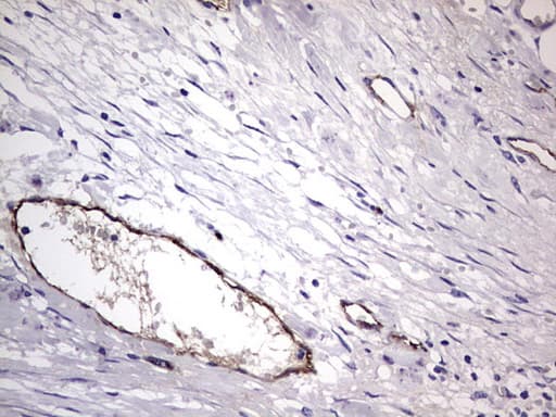 VWF / Von Willebrand Factor Antibody (aa764-1263, clone OTI6C7)