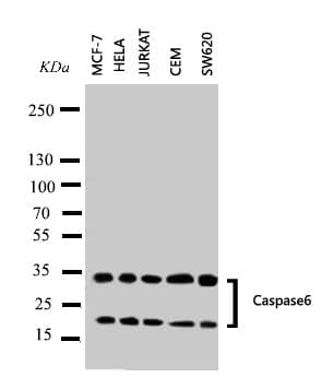 Polyclonal Rabbit anti-Human CASP6 / Caspase 6 Antibody (aa24-44, IHC, WB)