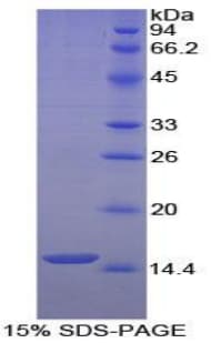 Human HTN1 / Histatin-1 Protein (Recombinant His-S)