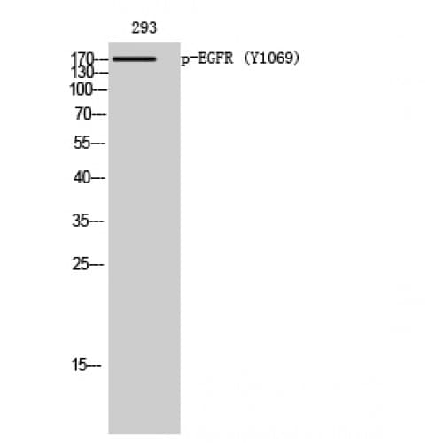Polyclonal Rabbit anti-Human EGFR Antibody (1010-1090 aa, WB)