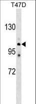 Polyclonal Rabbit anti-Human ATP2C1 Antibody (aa882-909, WB)