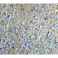 NRTN / Neurturin Antibody