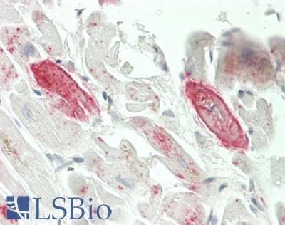 IHC-plus™ ANXA7 / Annexin VII / SNX Antibody (Internal)