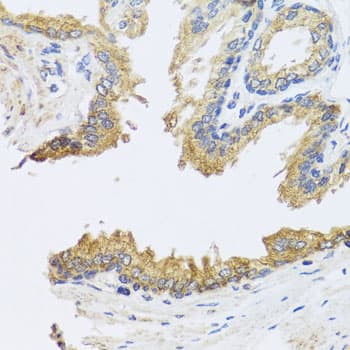 IHC-plus™ ARL6 Antibody