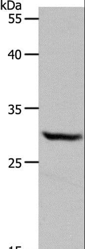 NQO1 Antibody