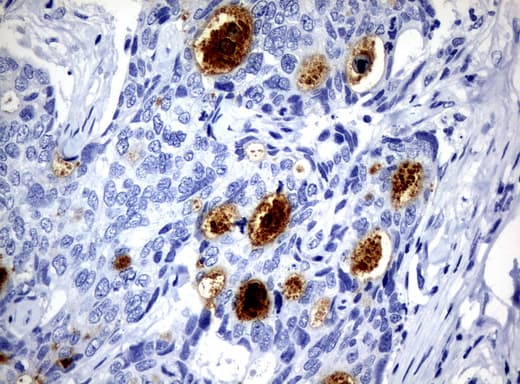 WFDC2 / HE4 Antibody (aa31-124, clone UMAB87)