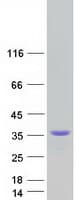 Human CTRP10 / C1QL2 Protein (Recombinant Myc-DDK (Flag))
