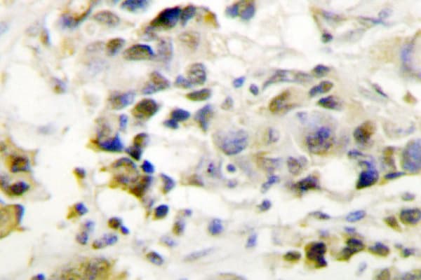 MED1 / TRAP220 Antibody (Pro697)