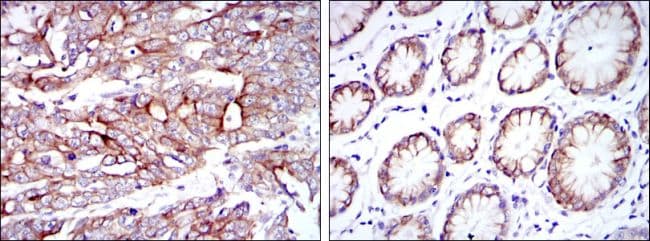 KRT19 / CK19 / Cytokeratin 19 Antibody (clone 1H6)