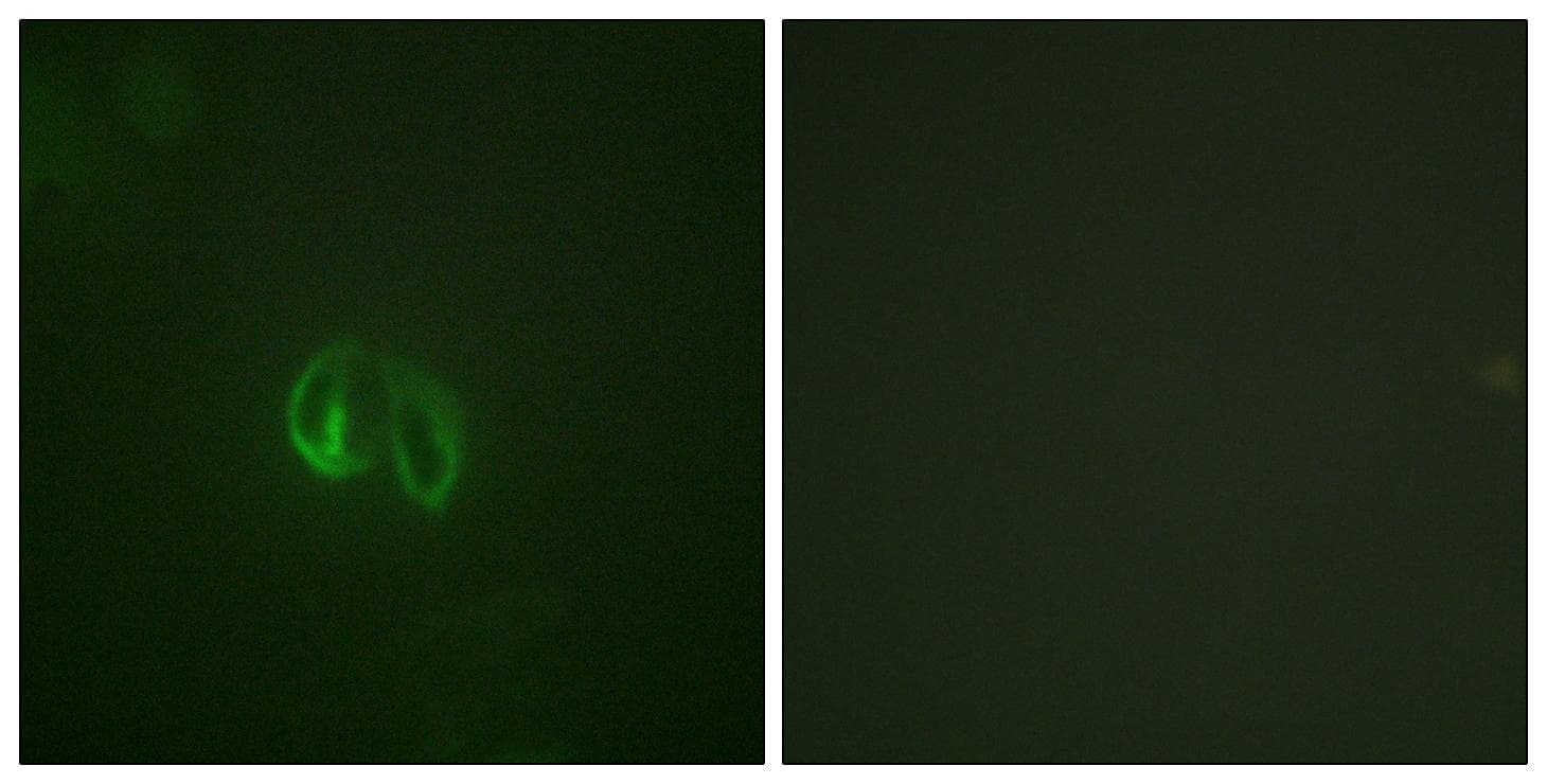 IL10RA Antibody (p496)