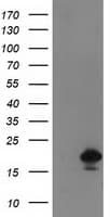 DSTN / Destrin Antibody (clone OTI1D5)