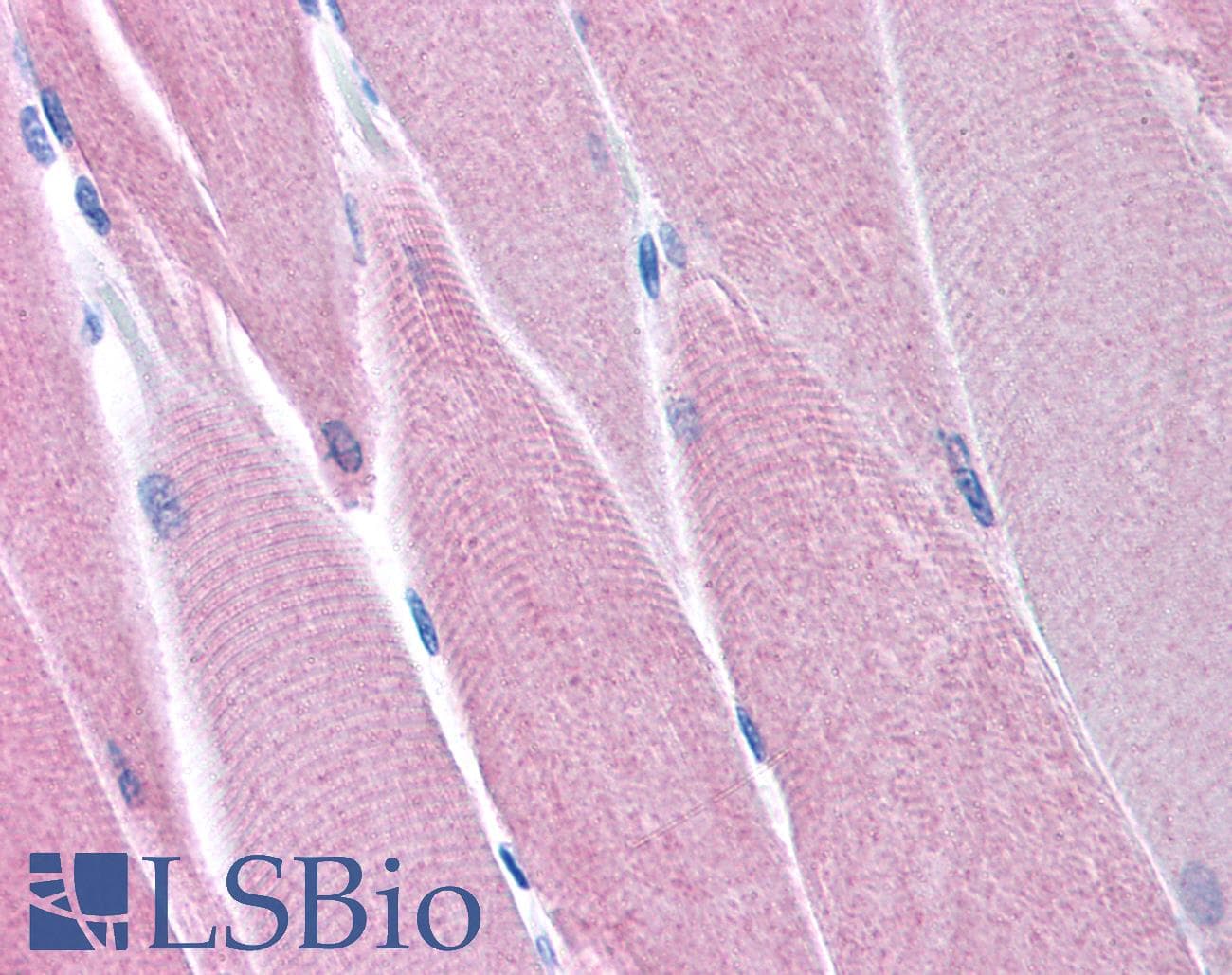 PDK4 Antibody (N-Terminus)
