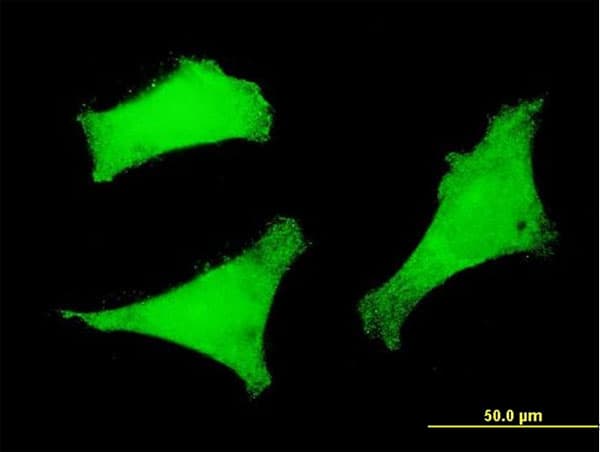IHC-plus™ FOXO3 / FOXO3A Antibody (clone 4F2)