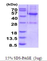 Human ELAC1 Protein (Recombinant His)