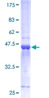 Human HPCA / Hippocalcin Protein (Recombinant GST)
