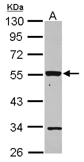P2RX2 / P2X2 Antibody