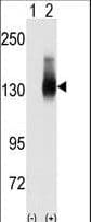 Polyclonal Rabbit anti-Human JAG2 / Jagged-2 Antibody (aa1209-1238, IHC, WB)
