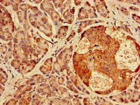 AGPAT3 Antibody