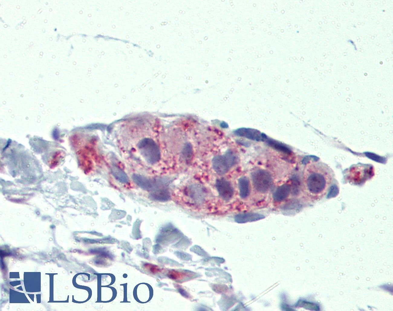 TNKS / Tankyrase Antibody (aa972-1021)