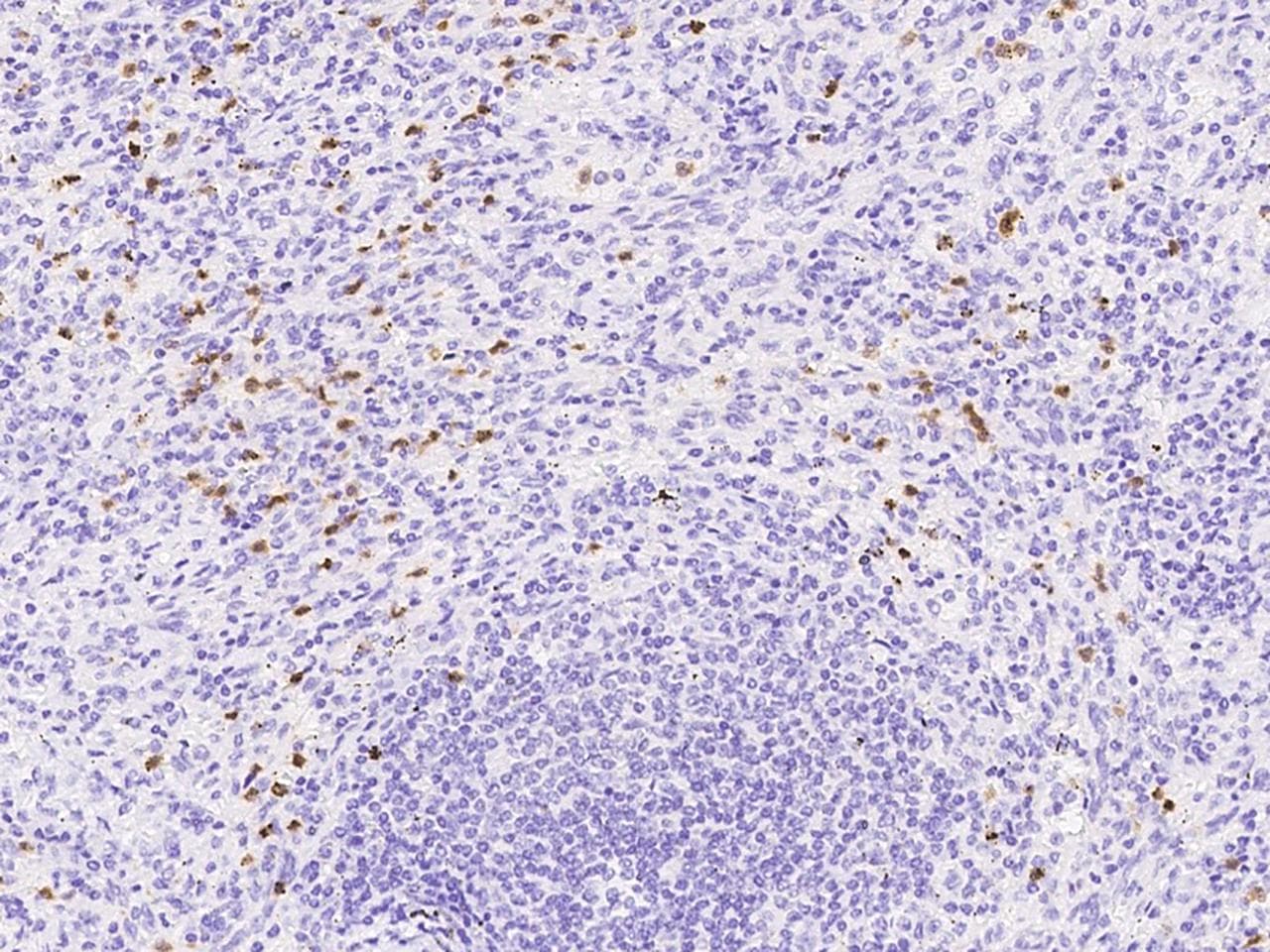Polyclonal Rabbit anti-Human CYBB / NOX2 / gp91phox Antibody (IHC)