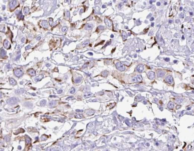 Polyclonal Rabbit anti-Human SMAD5 Antibody (IHC, IF, WB)