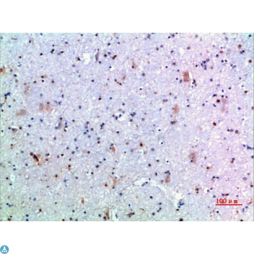 GH / Growth Hormone Antibody