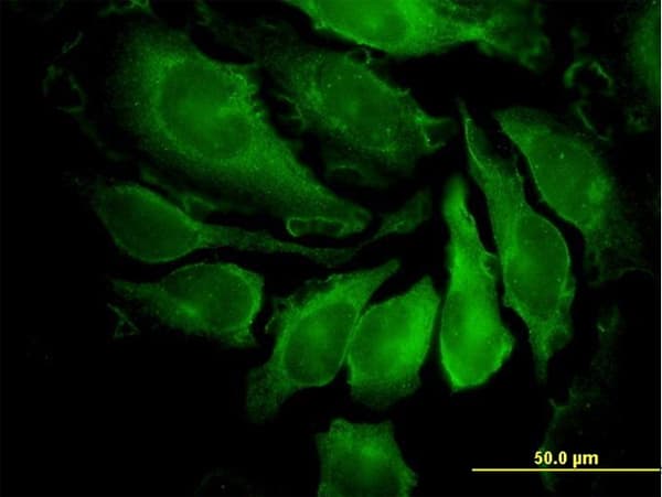 Monoclonal Mouse anti-Human PAK1 Antibody (clone 4D1, IF, WB)