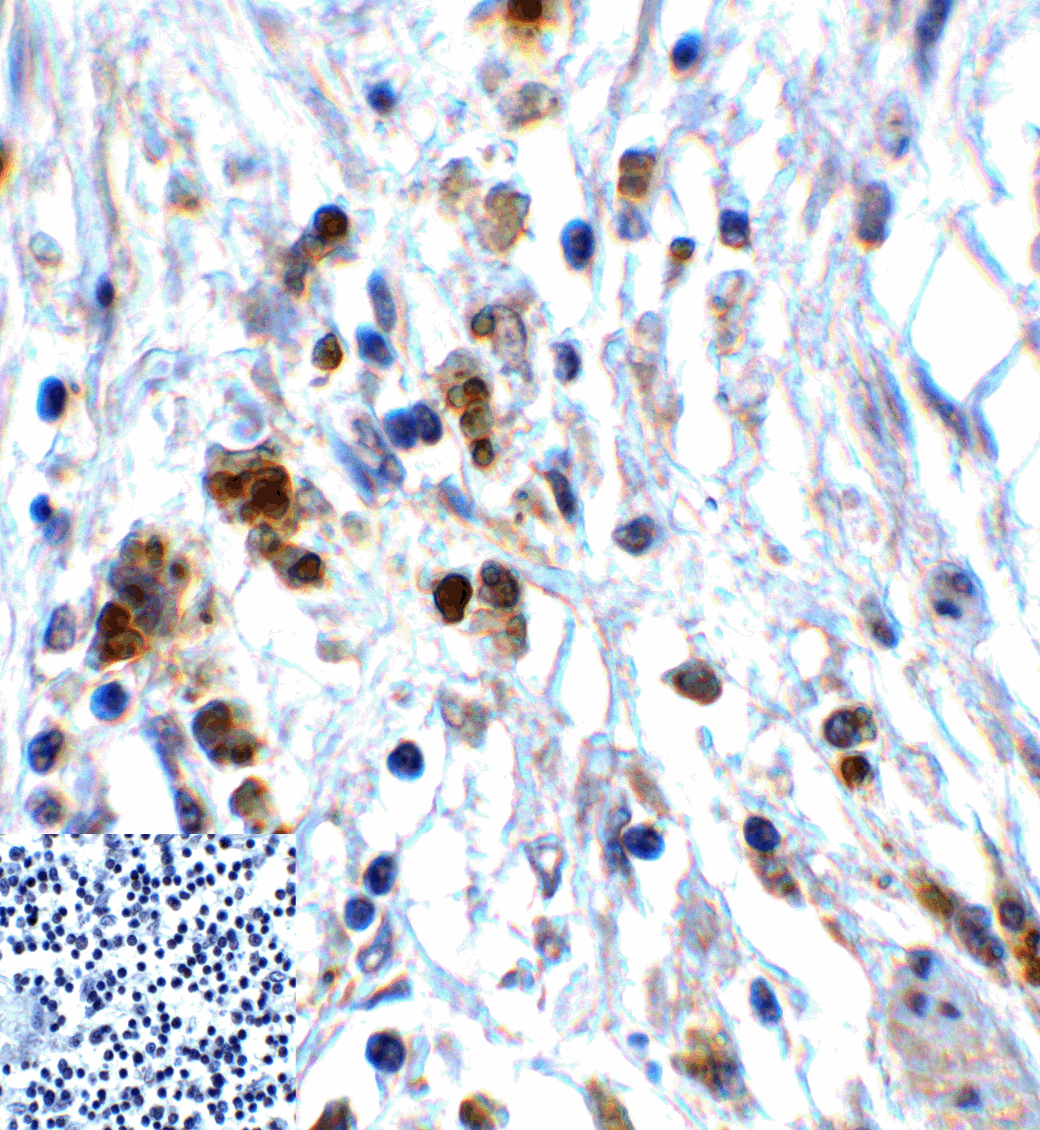 Monoclonal Mouse anti-Human TIGIT Antibody (clone 10B1, IHC, IF)