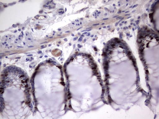 MKI67 / Ki67 Antibody (aa1160-1493, clone OTI1D9)
