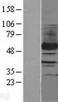 PFKFB4 Protein (Over-Expression Lysate Myc-DDK (Flag))