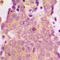 Polyclonal Rabbit anti-Human NSG1 Antibody (Internal, IHC, WB)