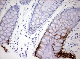 KRT20 / CK20 / Cytokeratin 20 Antibody (clone OTI11A1)